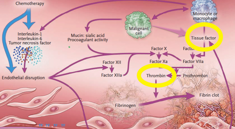 20 Effect of cancer cells on coagulation system 241