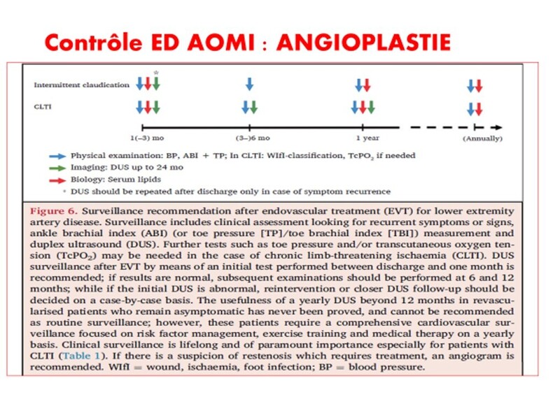 ESVS21