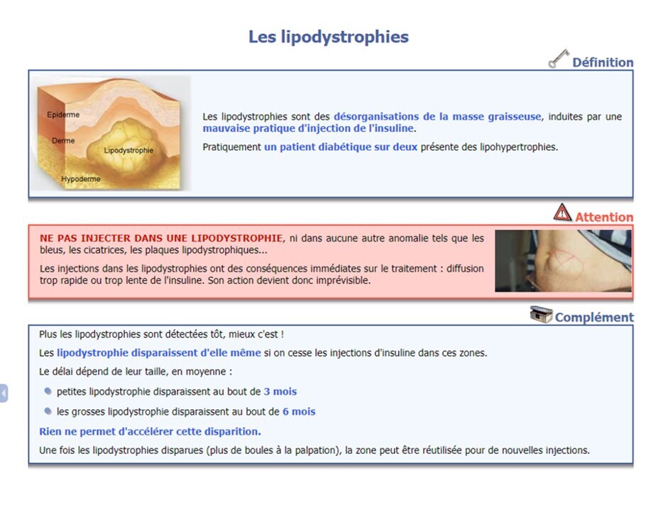 LIPODYSTROPHIEMM