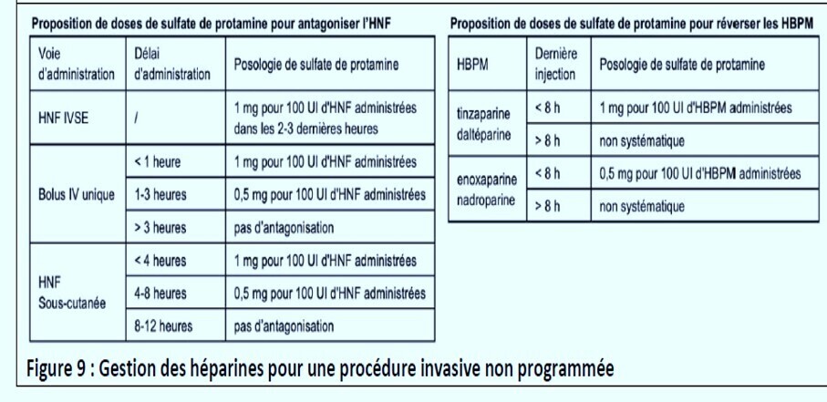 SFAR35