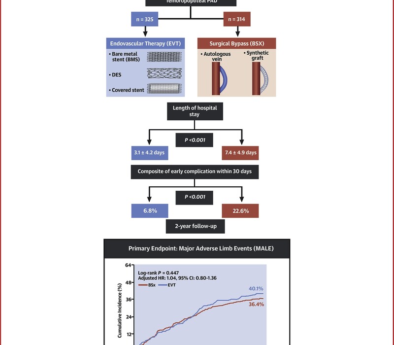 STENTING1