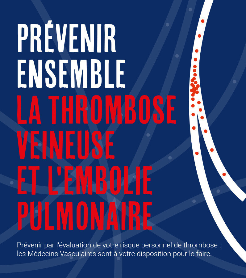 affiche wtd