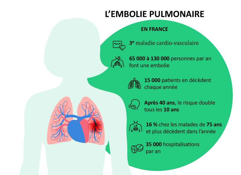embolie pulmonaire chiffres