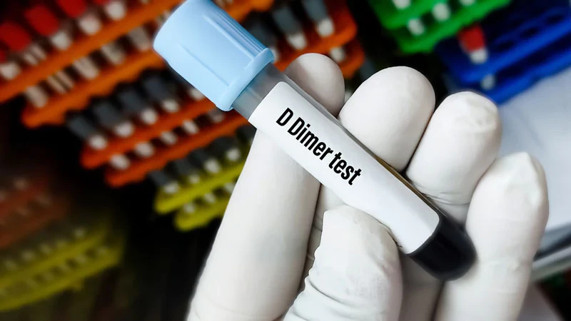 gty 211013 d dimer blood test 800x450