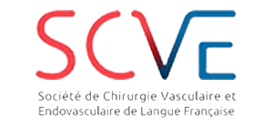 logo scve