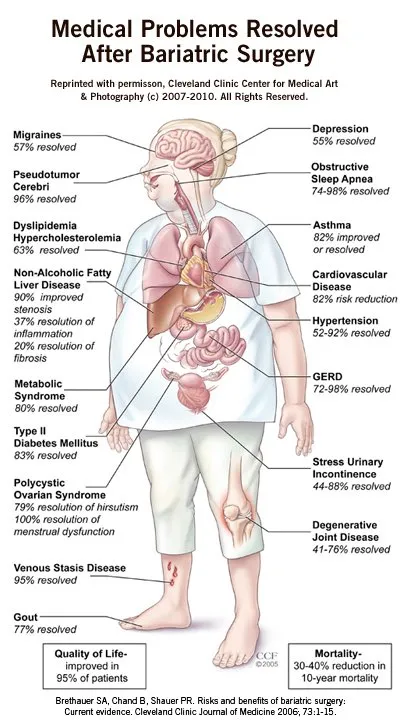 Comorbidity Res Graphic