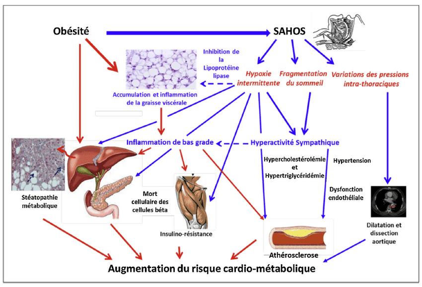 Augmentation du risque cardio metabolique
