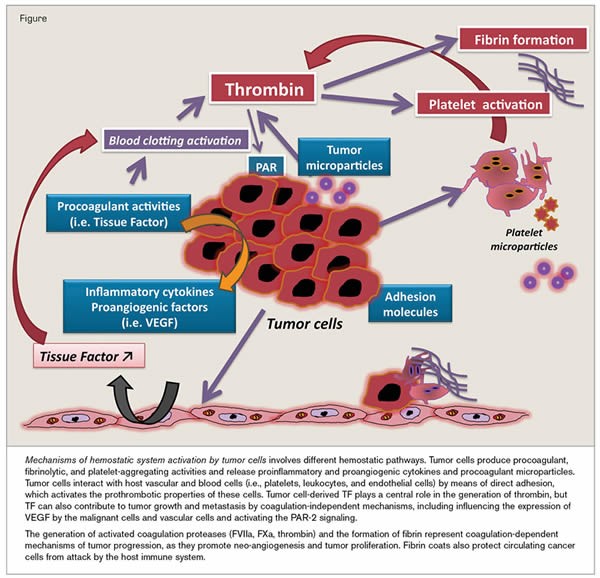 Cancer induces hyoercoagulability