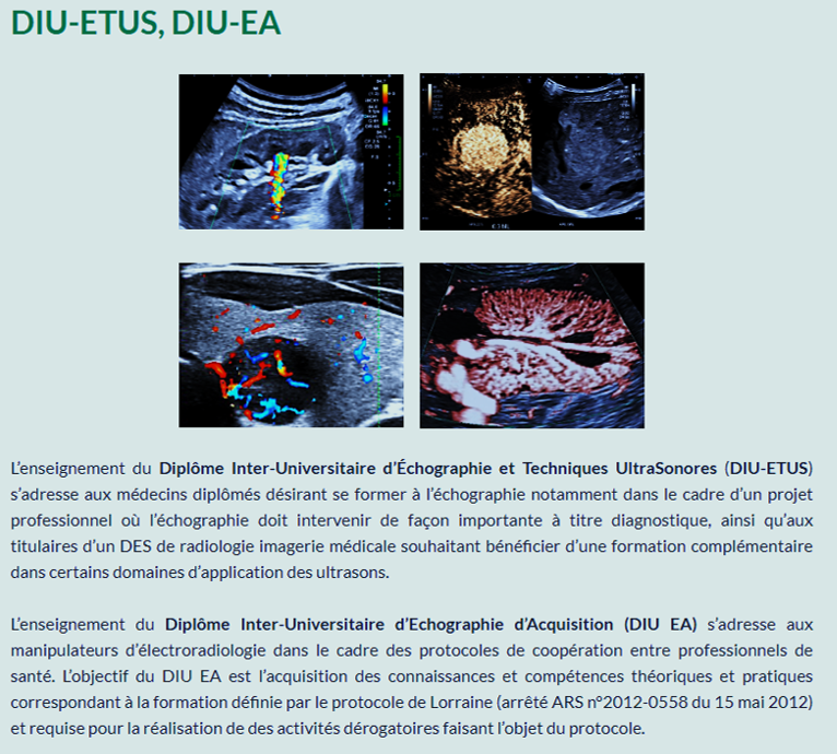 DIUETUS
