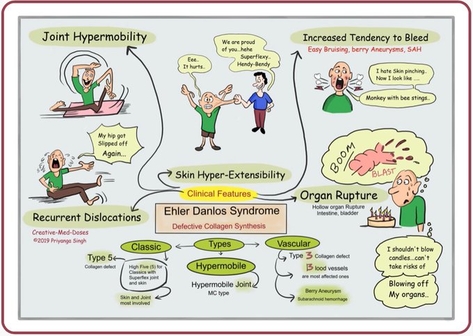 EHLER DANLOS