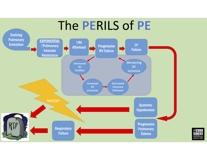 Infographic Pulmonary Embolism copy