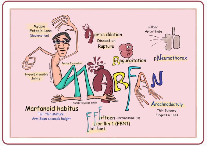 Marfan