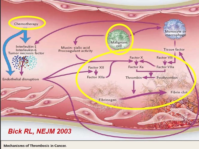 NEJMMECA