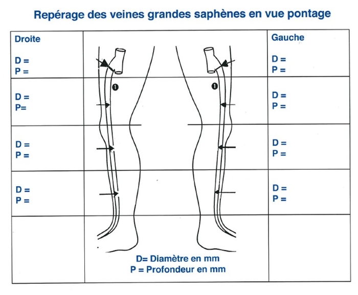 REPERAGESAPHENE