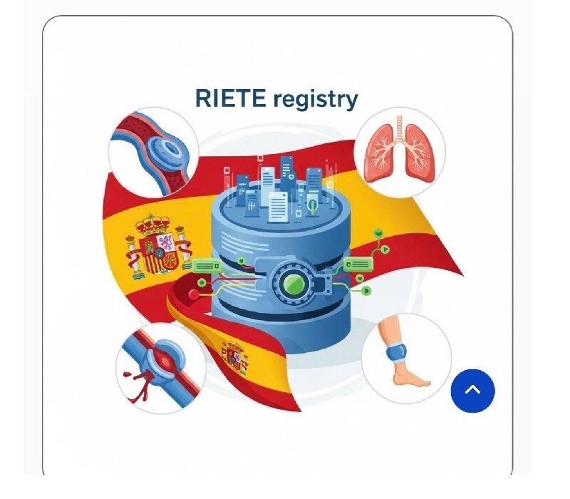 RIETE EXPRESS : TVP distales 
