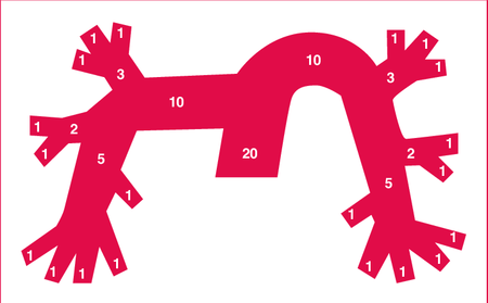 Schematic representation of the arterial tree of the lung and the Qanadli score