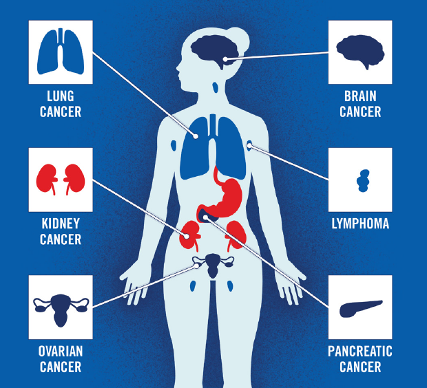 cancer wtdisth