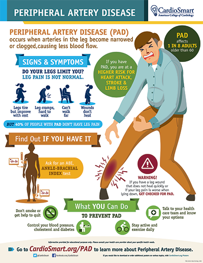 peripheral arterial disease