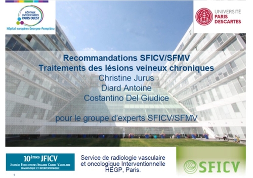 sficvsfmv